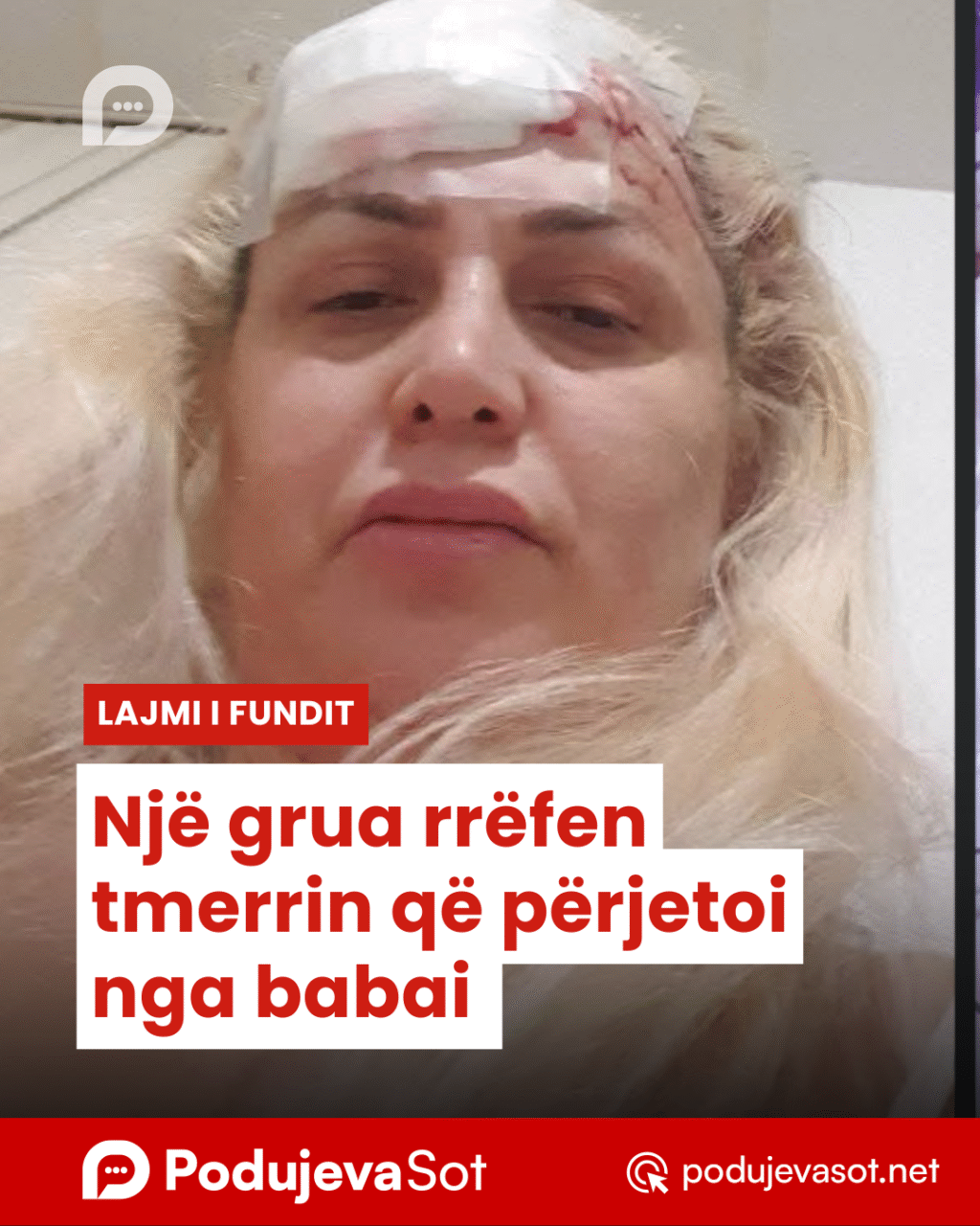 Copy of Copy of Podujeva Sot Telefon