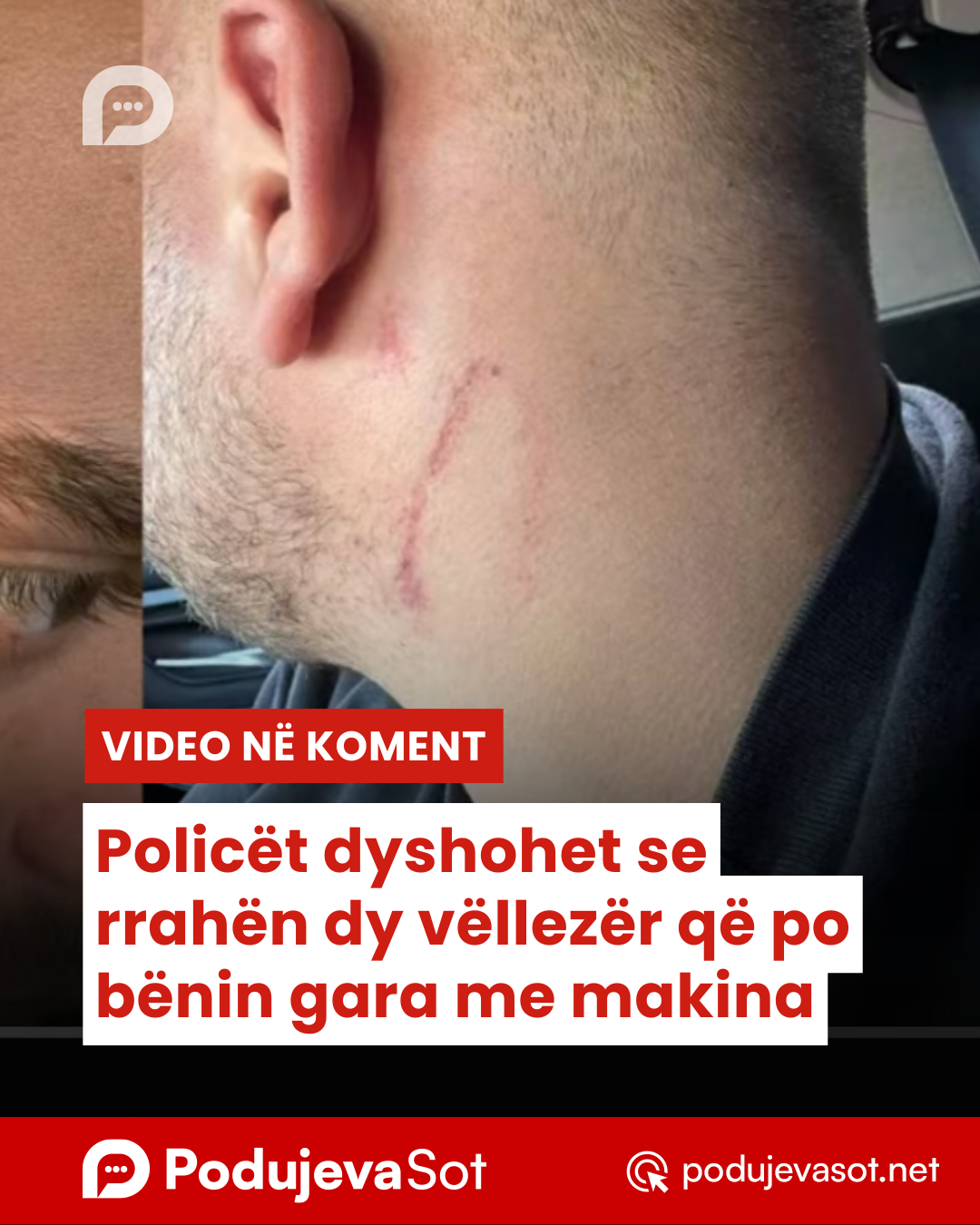 Copy of Podujeva Sot Telefon