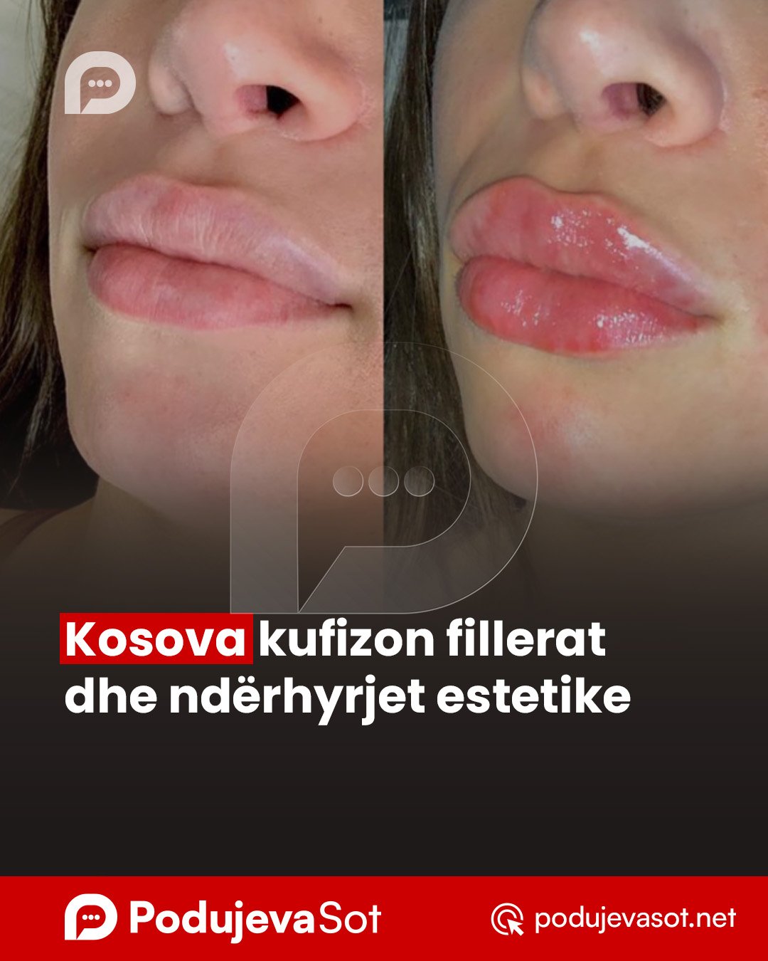 PD_Postim